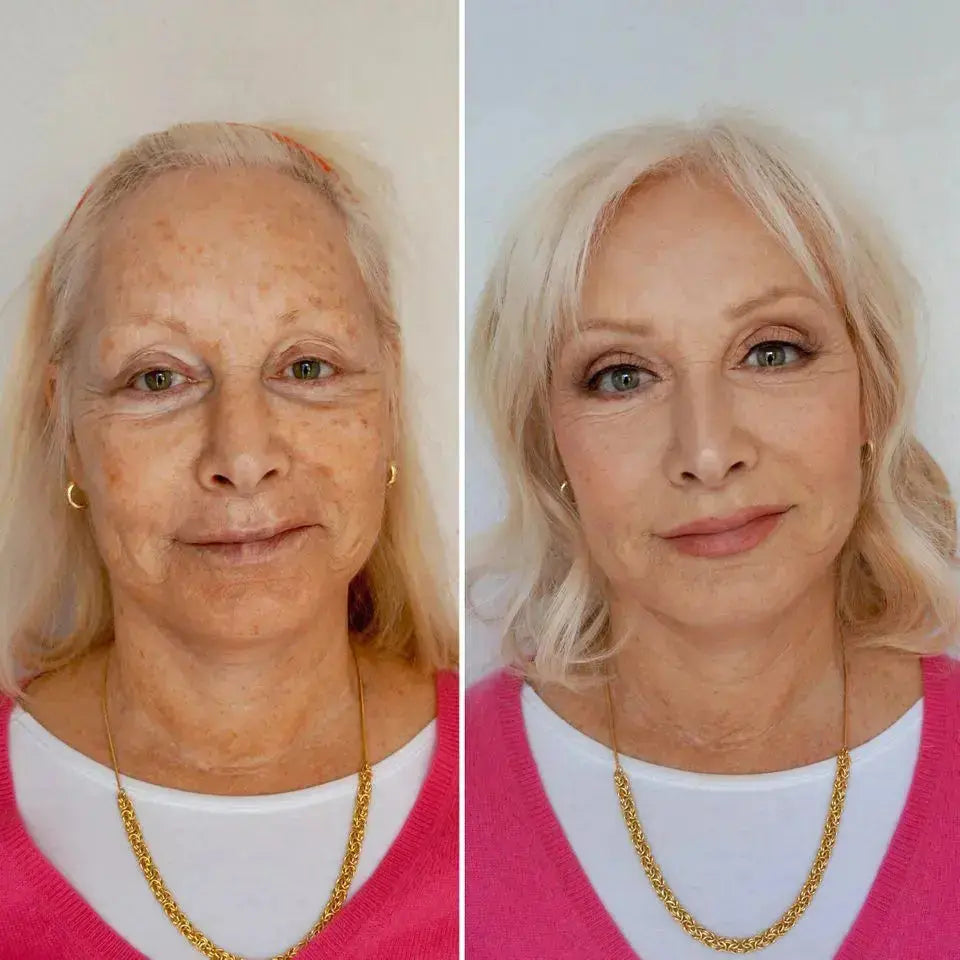 Ageless Skin Kit (+2 Free Gifts)